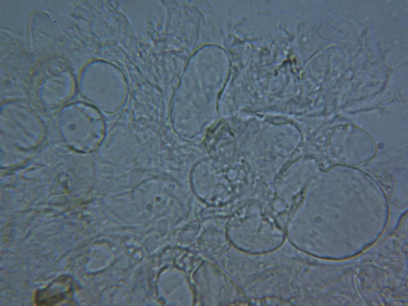 Agrocybe praecox 10 - Pileipellis frontal 1